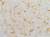 <b>JGS-25112@</b>